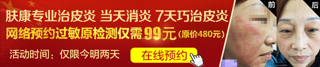 皮炎.gif