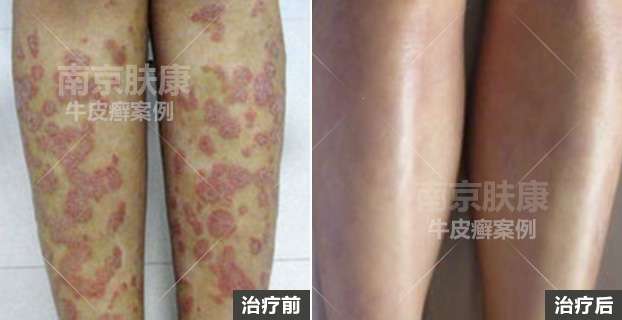 niupixuan1.jpg